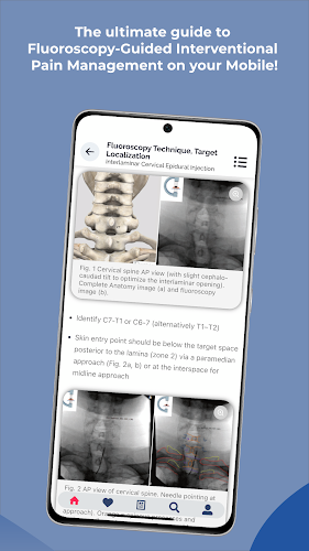 Interventional Pain App ဖန်သားပြင်ဓာတ်ပုံ 4