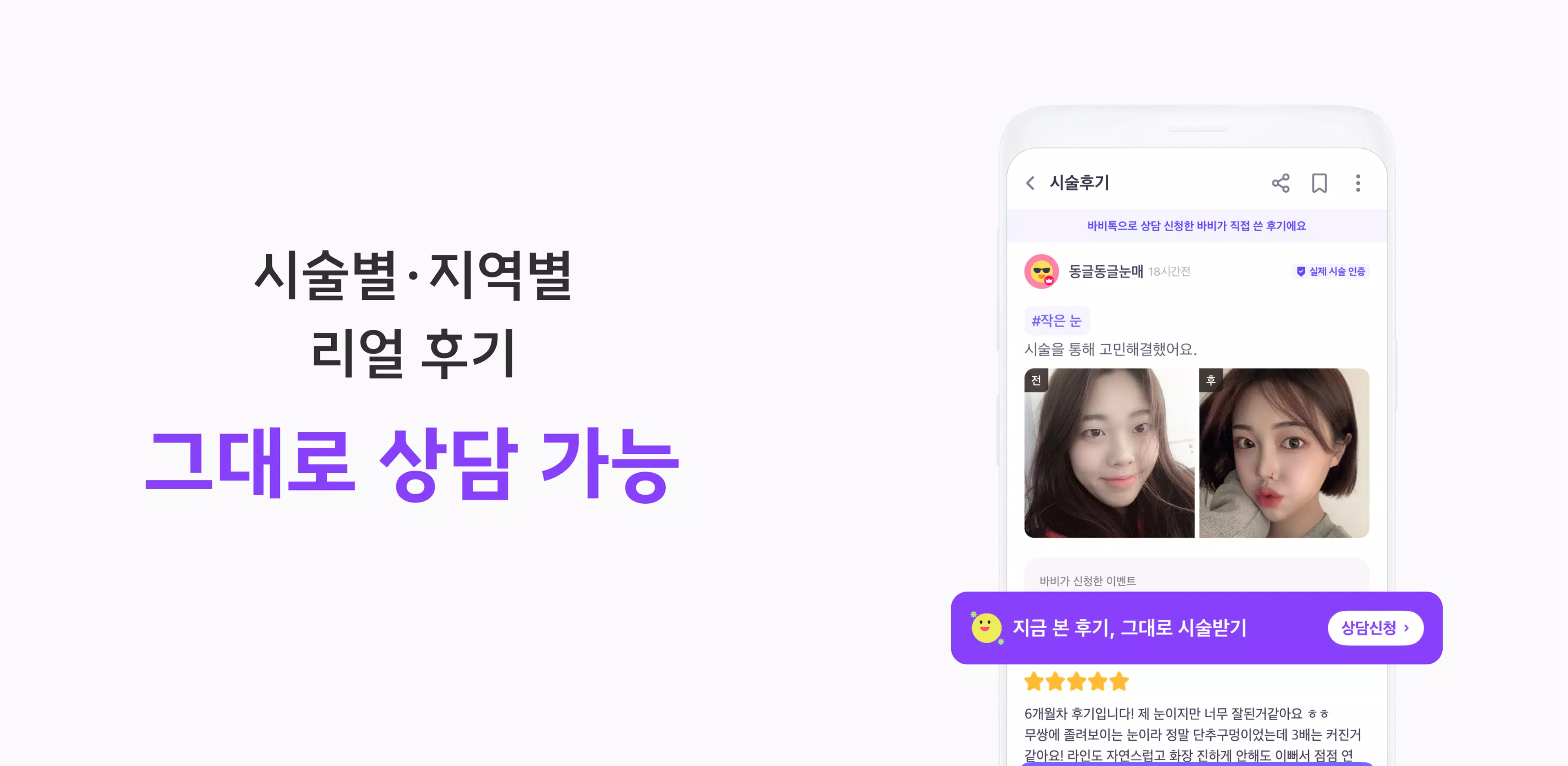 바비톡 - 성형 시술 성형외과 피부과 병원예약 성형어플 Screenshot 3