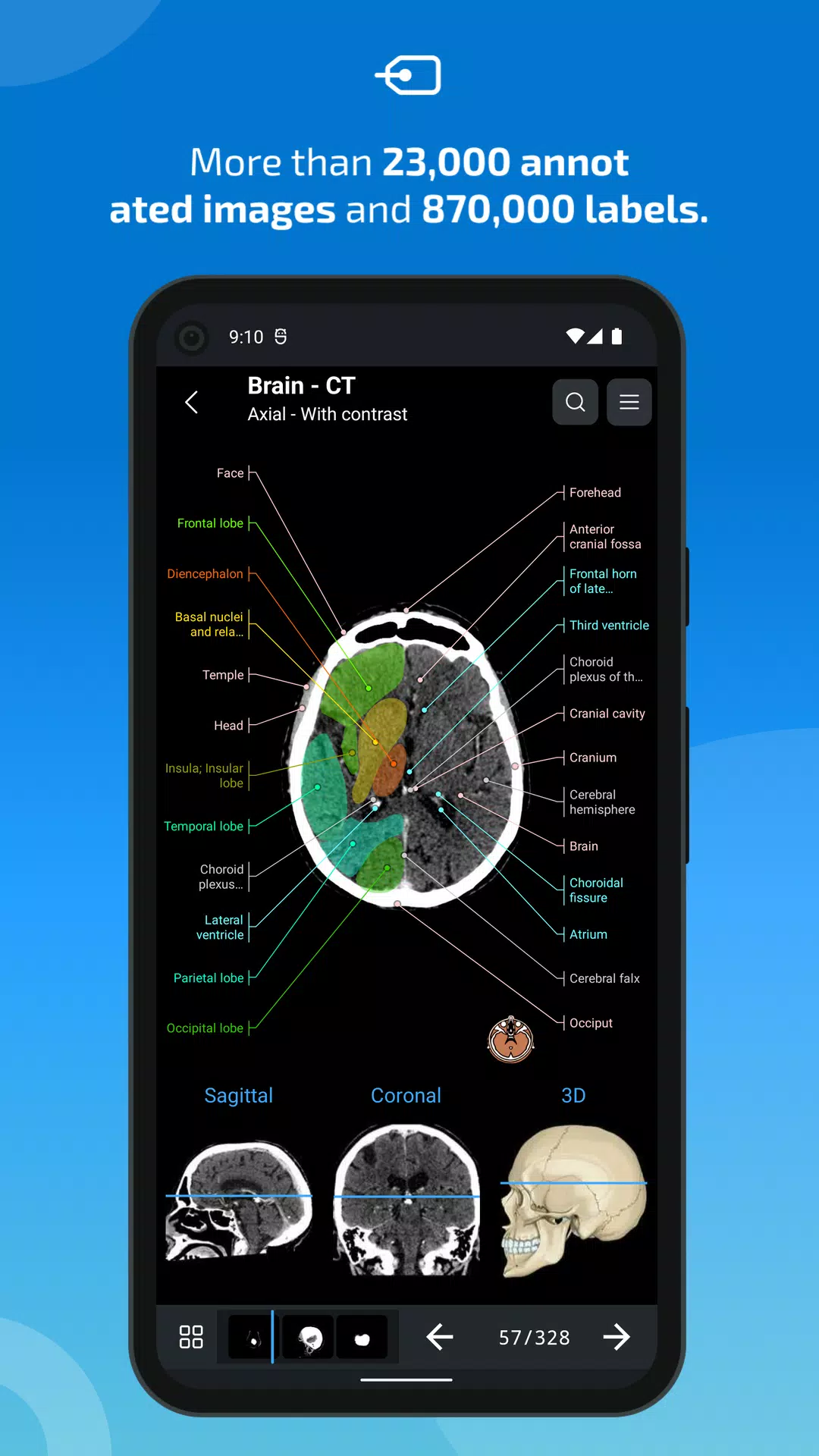 e-Anatomy Screenshot 2