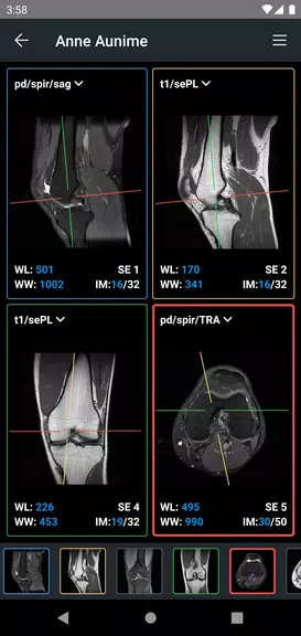 IDV - IMAIOS DICOM Viewer экрана 3