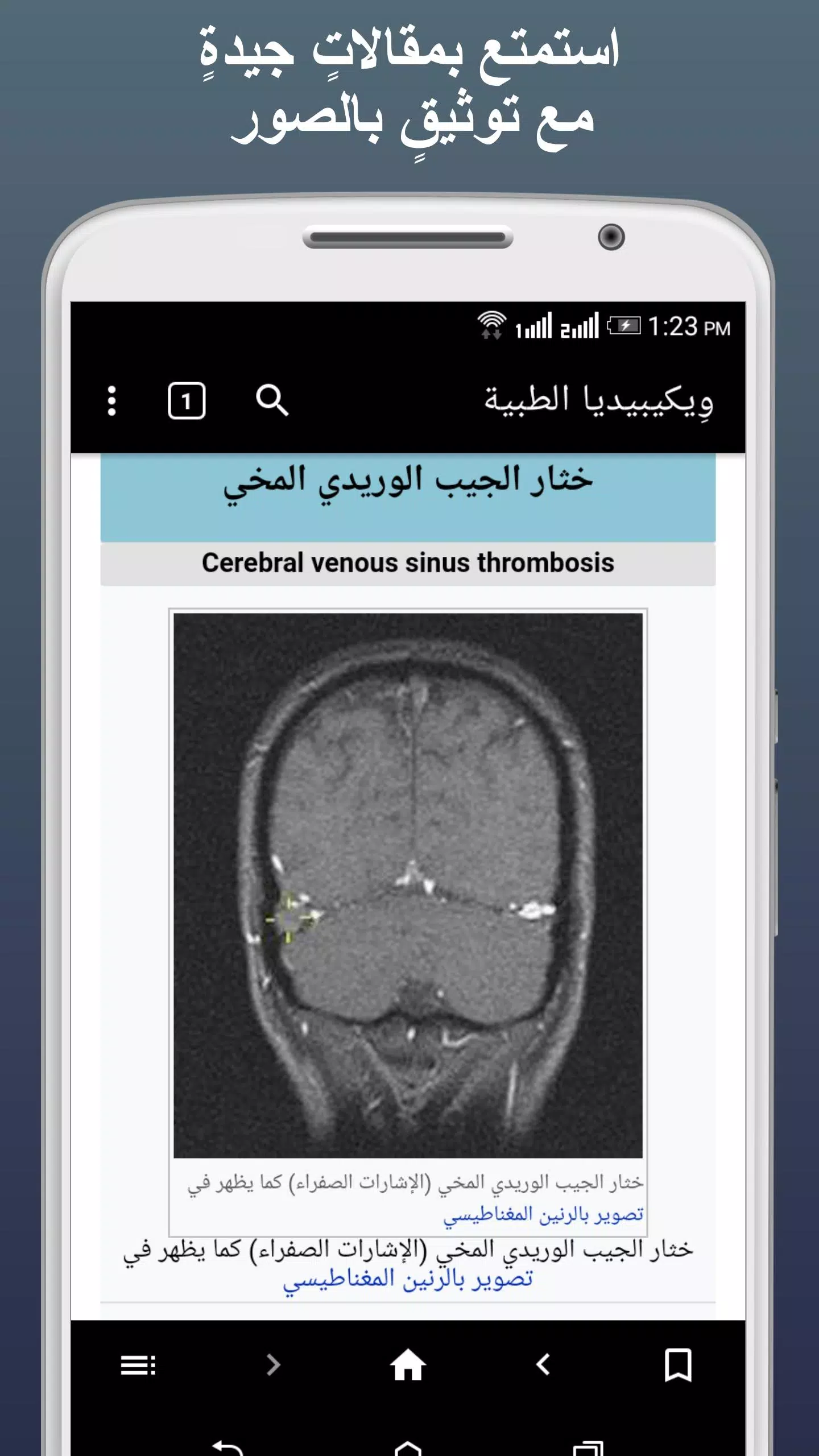ويكيبيديا الطبية ဖန်သားပြင်ဓာတ်ပုံ 3