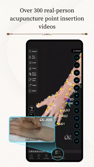 Acupuncture Master Screenshot 4