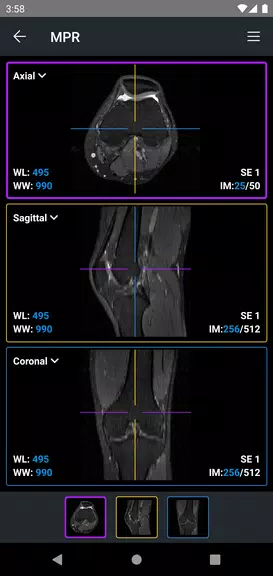 Screenshot IDV - IMAIOS DICOM Viewer 4