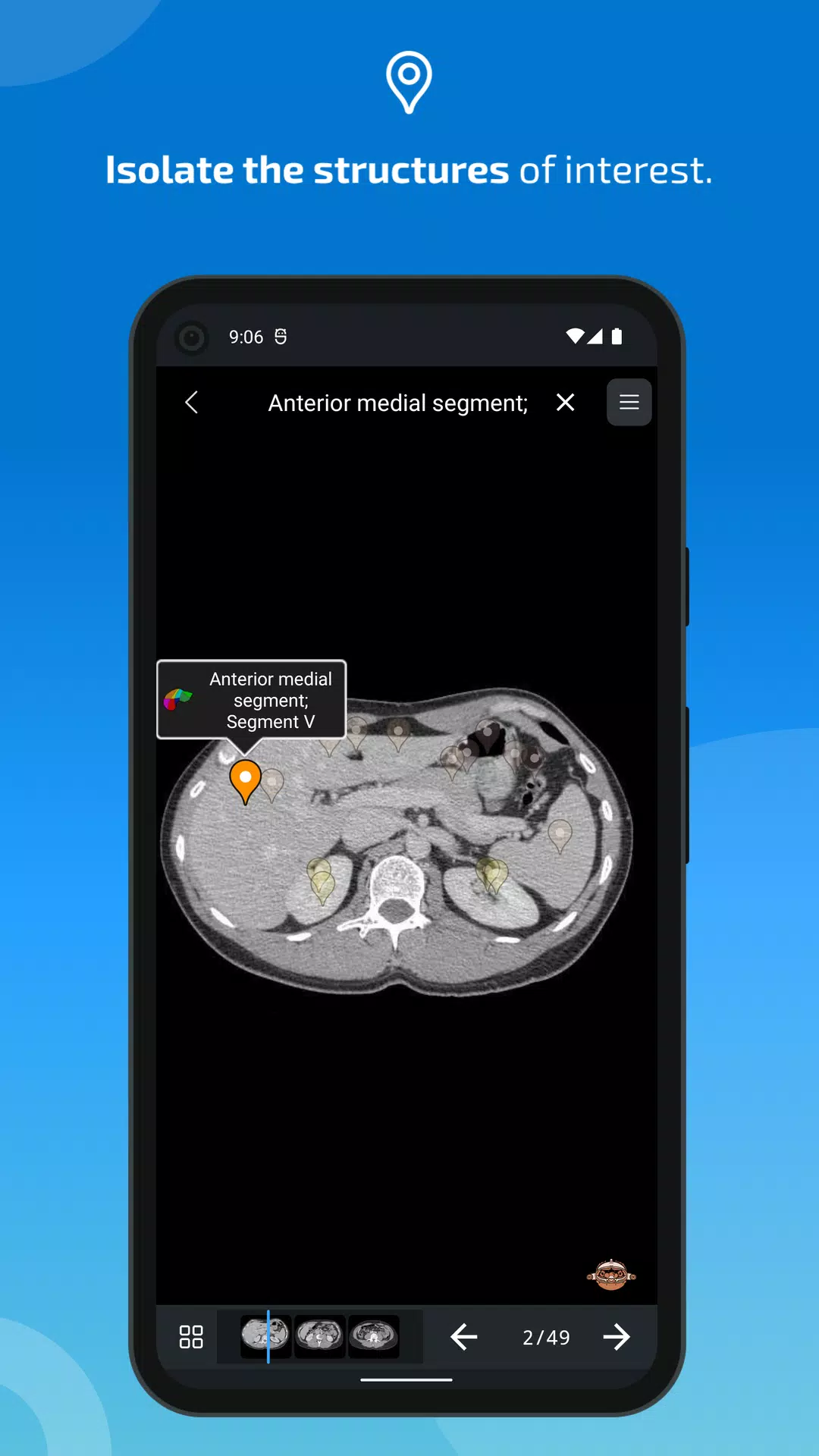 e-Anatomy Screenshot 4