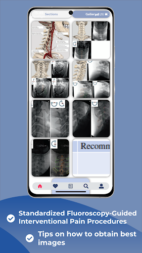 Interventional Pain App zrzut ekranu 3